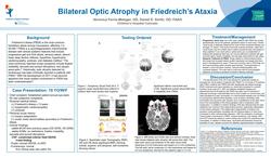 Bilateral Optic Atrophy in Friedreichs_s Ataxia-Veronica Ferris
